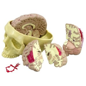 오픈메디칼GPI 뇌와 두개골 모형 G290